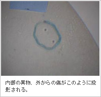 内部の異物、外からの傷がこのように投影される。