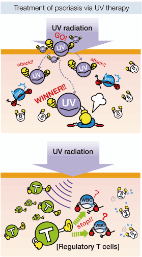 Treatment of psoriasis via UV therapy